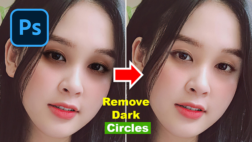 Reduce Dark Eye Pants With This Simple Way